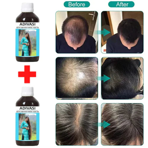 Adivasi Hair Herbal Premium Hair Oil 100ML OIL (BUY 1 GET 1 FREE) 4.9 ⭐⭐⭐⭐⭐